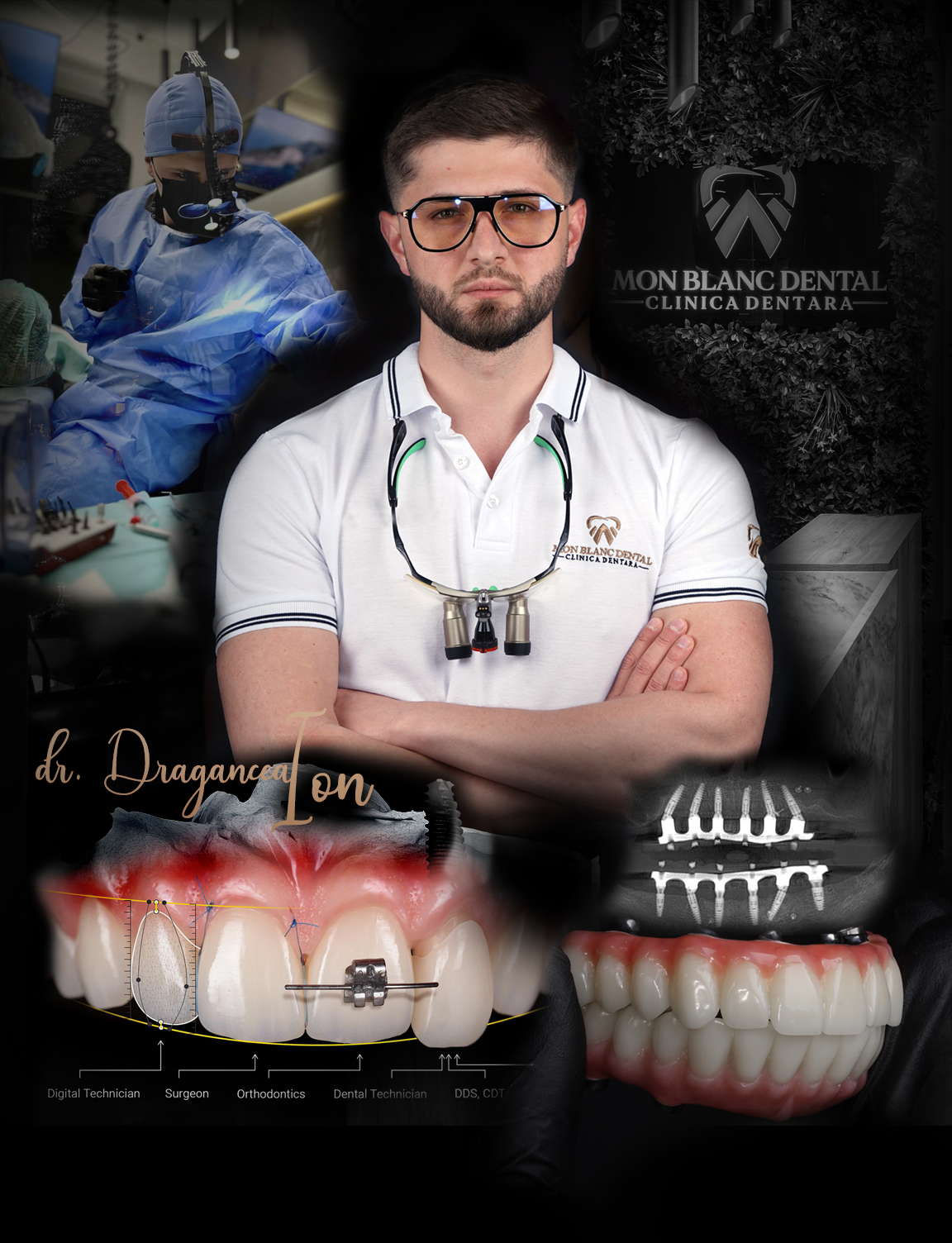 clinica dentara moderna Brasov mon blanc dental 1